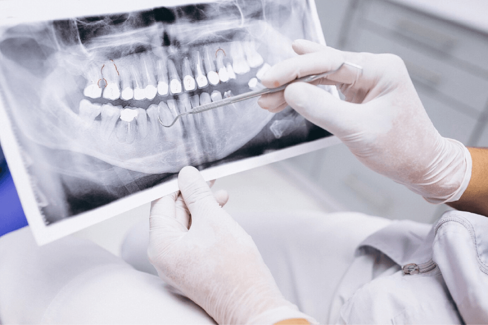 Odontoiatria Bernari - Studio Dentistico a Roma